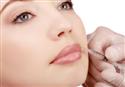 Oblikovanje lice - oblikovanje i povećanje usana, jagodica, obraza i brade injekcijama hijaluronske kiseline (hijaluron, fileri, punjači)